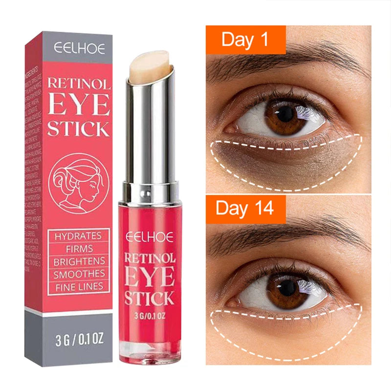 Retinol Anti Wrinkle Eye Cream Anti Aging Remove Dark Circles