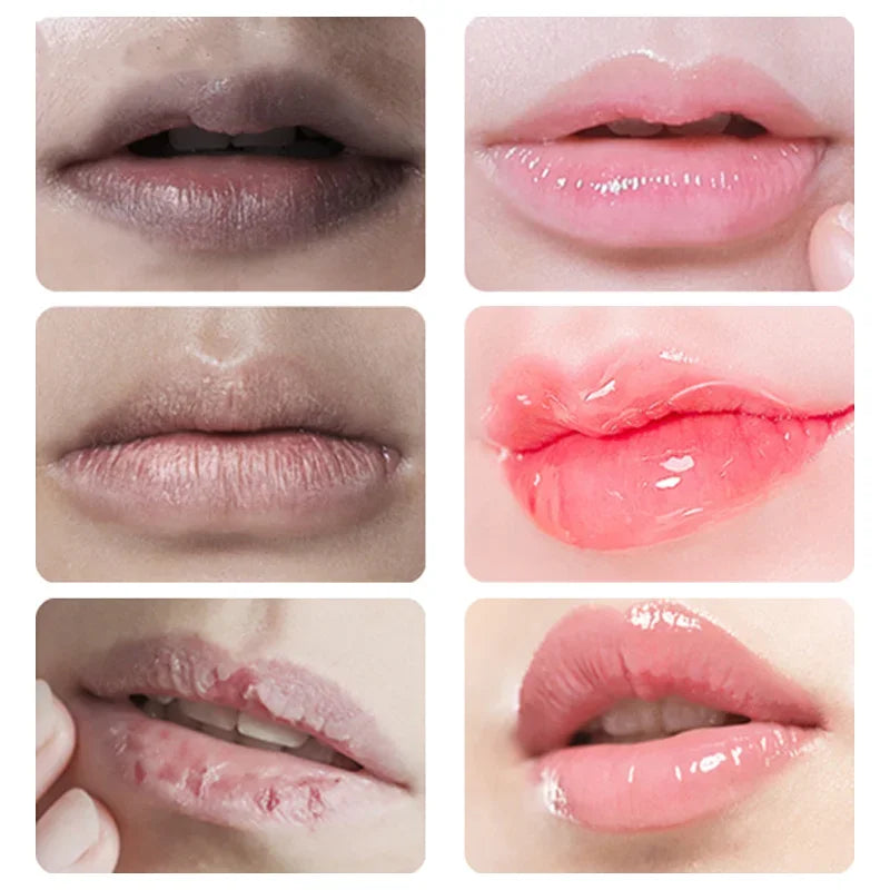 Remove Dark Lip Balm Lightening Melanin Mask Gloss Oil Exfoliating Clean Moisturizer