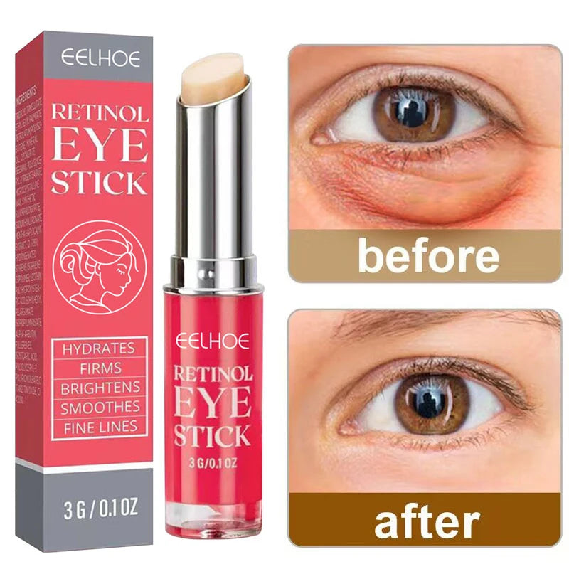Retinol Anti Wrinkle Eye Cream Anti Aging Remove Dark Circles