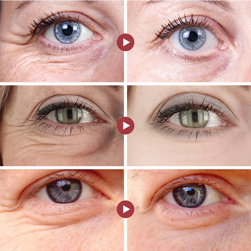 Retinol Anti Wrinkle Eye Cream Anti Aging Remove Dark Circles