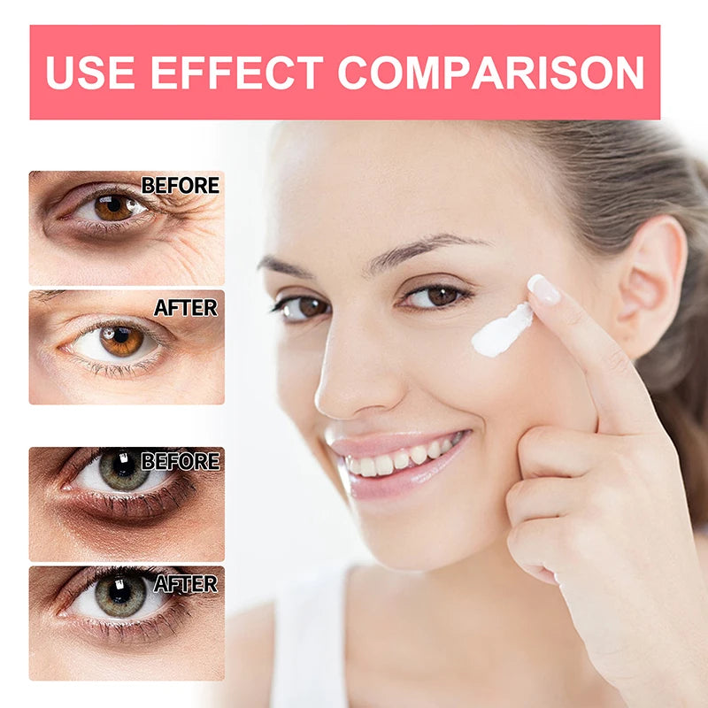 Retinol Anti Wrinkle Eye Cream Anti Aging Remove Dark Circles